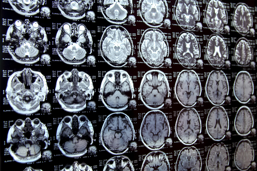 New AI system could accelerate clinical research