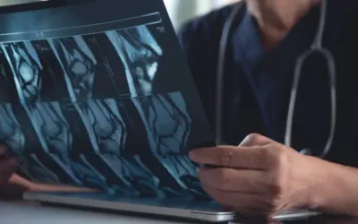 X-ray predicting AI could transform care – study