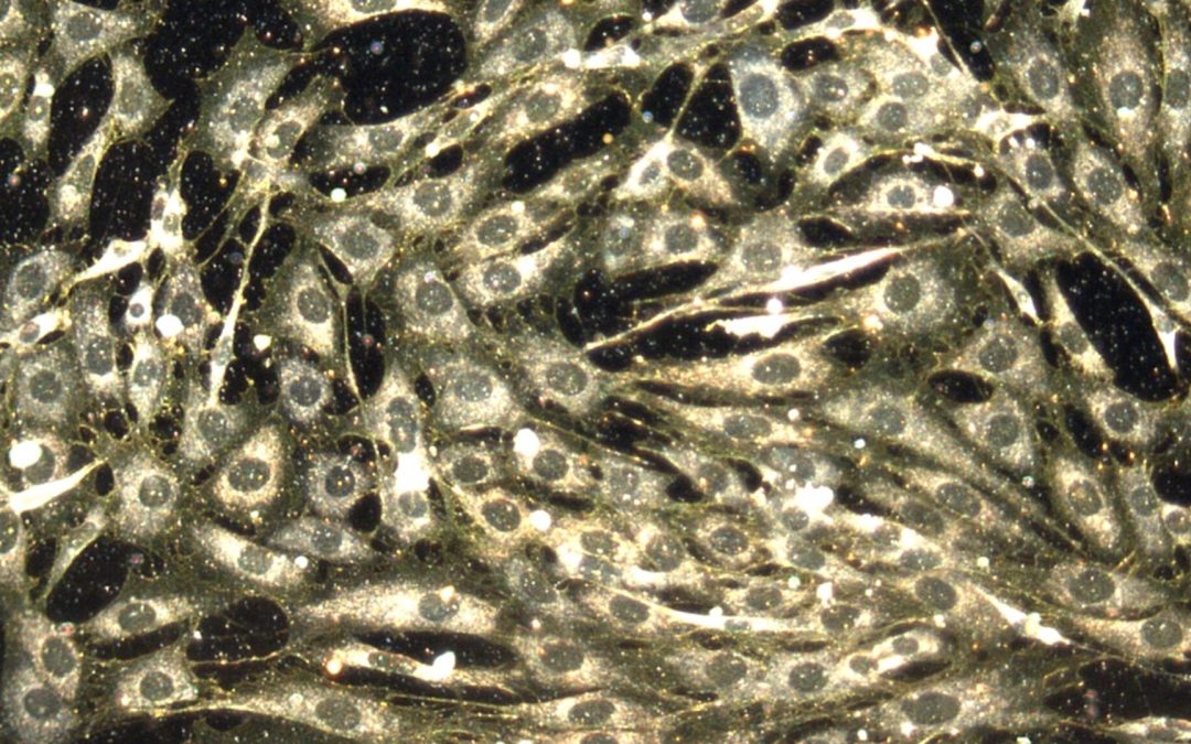 Chemo hurts both cancerous and healthy cells. But scientists think nanoparticles could help fix that.