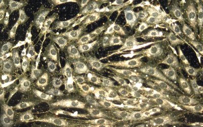Chemo hurts both cancerous and healthy cells. But scientists think nanoparticles could help fix that.