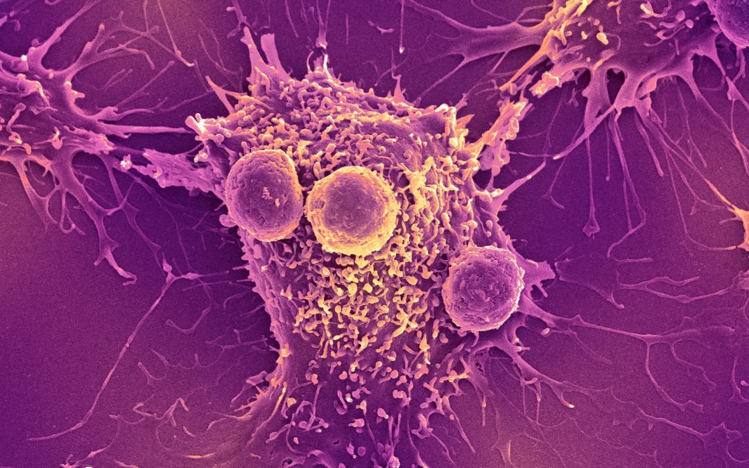 COVID-19 mRNA vaccines can trigger the immune system to recognize and kill cancer, research finds