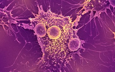 COVID-19 mRNA vaccines can trigger the immune system to recognize and kill cancer, research finds