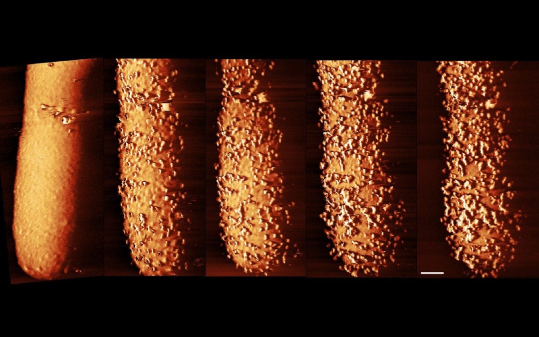 Striking images capture an antibiotic slaying bacteria in real time