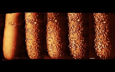 Striking images capture an antibiotic slaying bacteria in real time