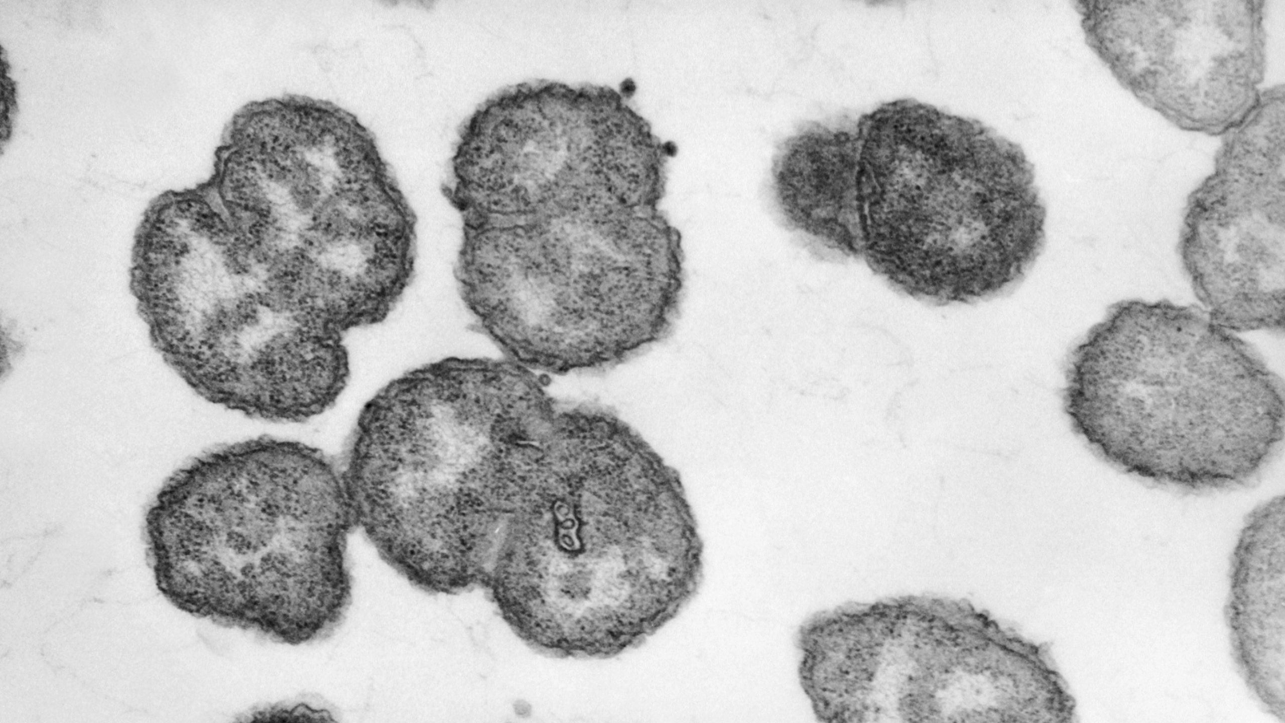 zGQiC47hHLQztvVdk8CyLh