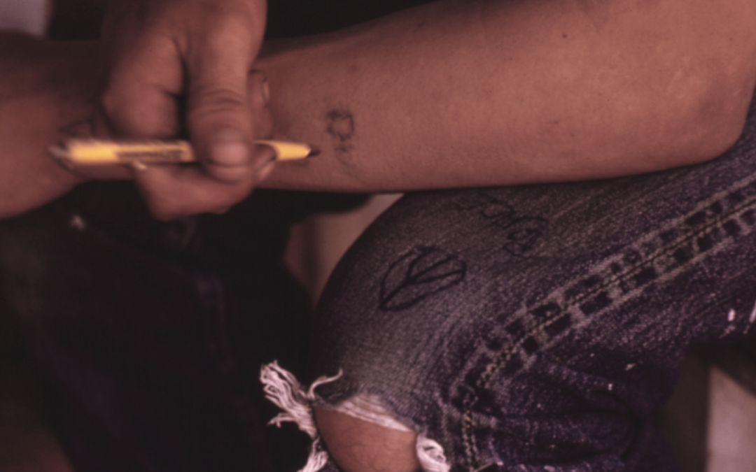 How are ‘traumatic tattoos’ made, and do you have one?