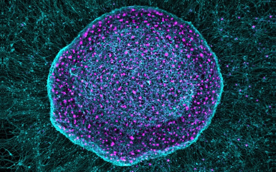 ‘Pain sponge’ derived from stem cells could soak up pain signals before they reach the brain