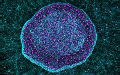 ‘Pain sponge’ derived from stem cells could soak up pain signals before they reach the brain