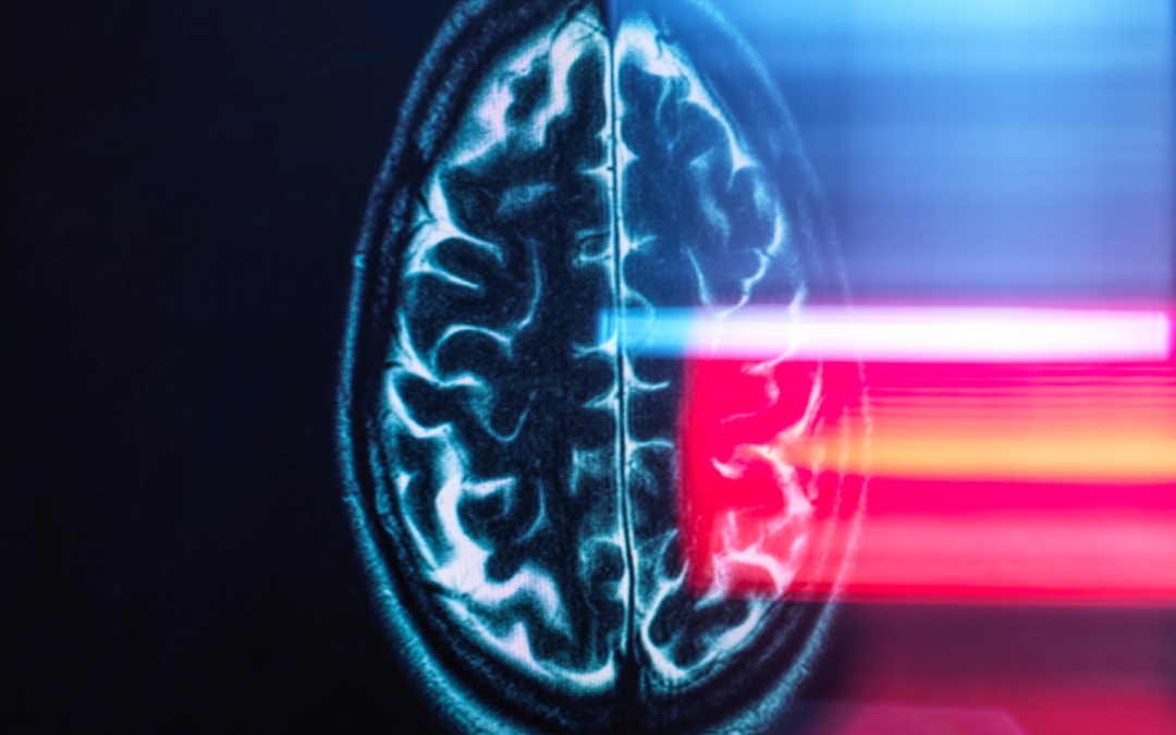 ‘The brain consistently moved upward and backward’: Astronauts’ brains physically shift in their heads during spaceflight