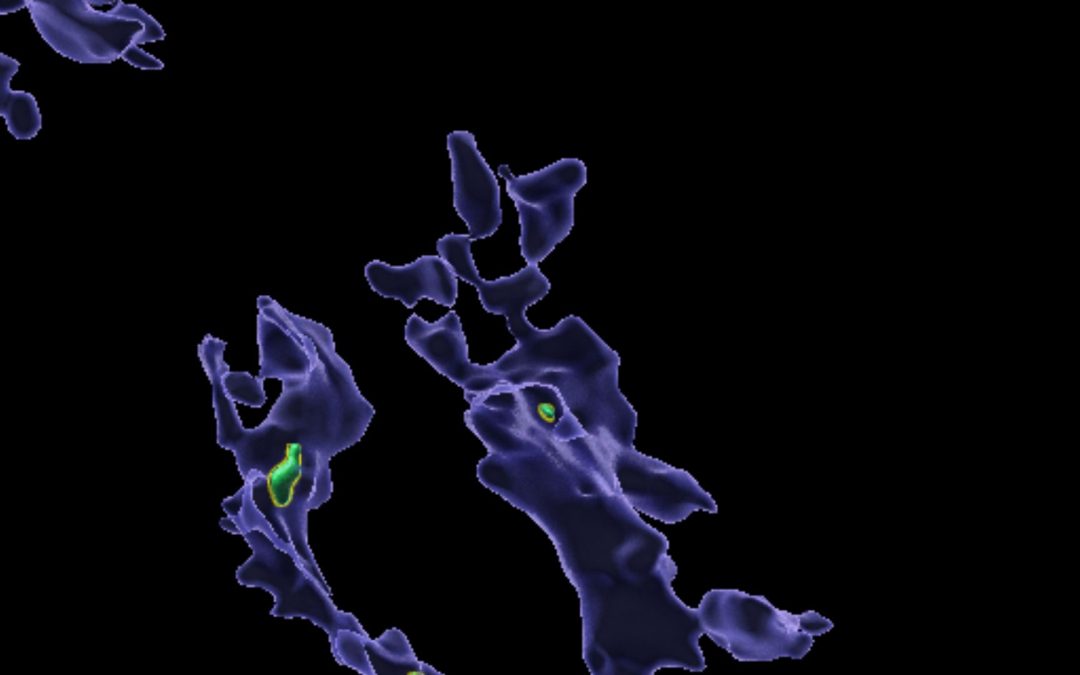 Microplastics that accumulate in the body may ‘clog up’ immune cells