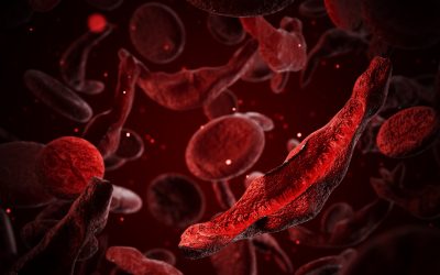 $3 million prize goes to duo whose research led to first sickle cell CRISPR therapy