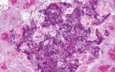 Scientists cured type 1 diabetes in mice by creating a blended immune system